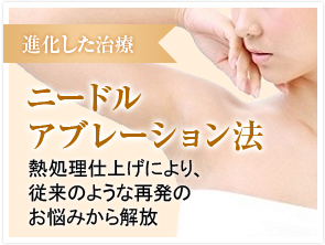 ニードルアブレーション法